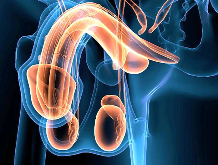 Male reproductive system showing testicular cancer
