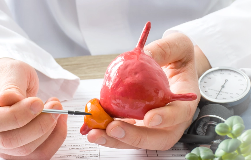 Prostate enlargement specialist pointing to the enlarged prostate on an anatomy model